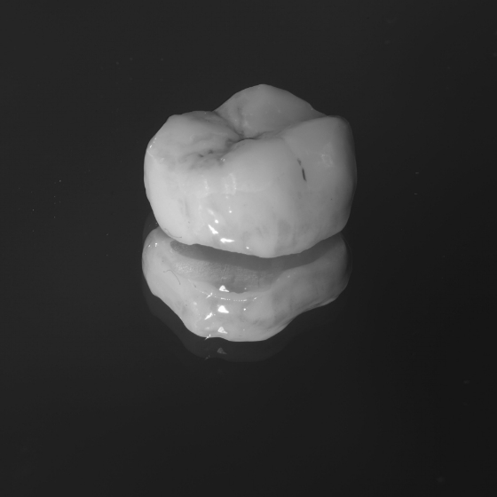 White dental crown against black background