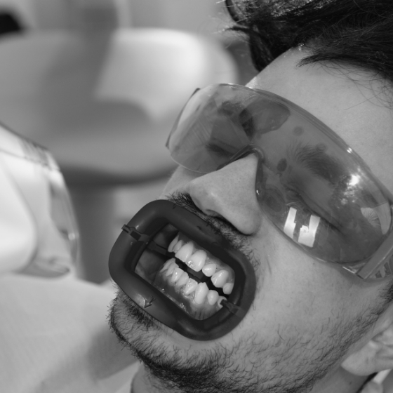 Man getting professional teeth whitening in dental office