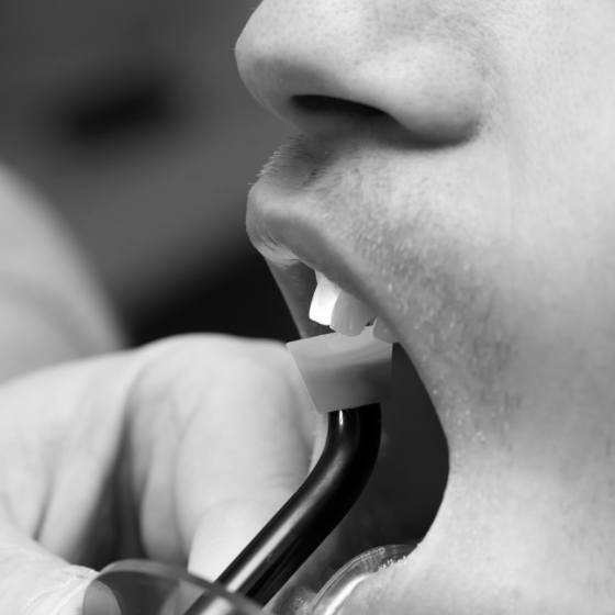 Dental patient getting direct bonding on a front tooth