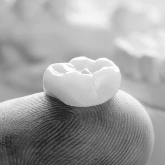 Dental crown resting on a finger