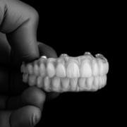 Hand holding an implant denture model