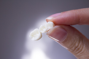 Holding dental bridge between fingers